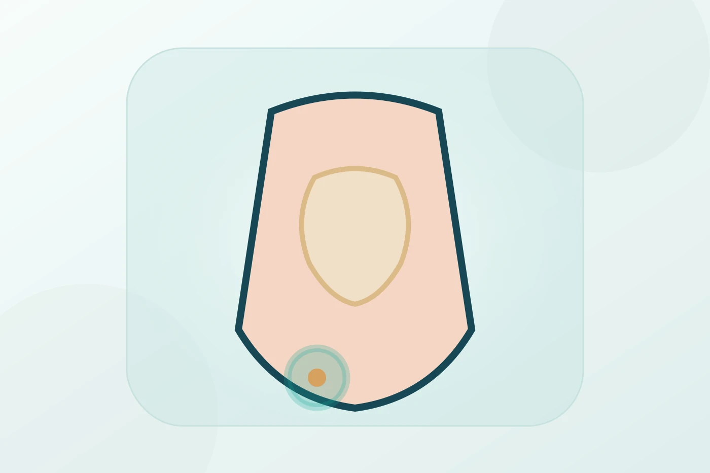 Femoral Hernia Repair