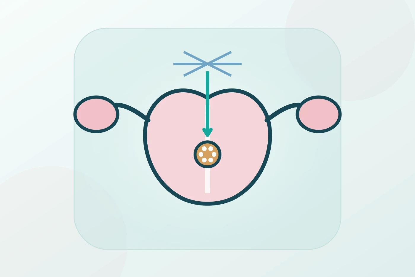 Frozen Embryo Transfer