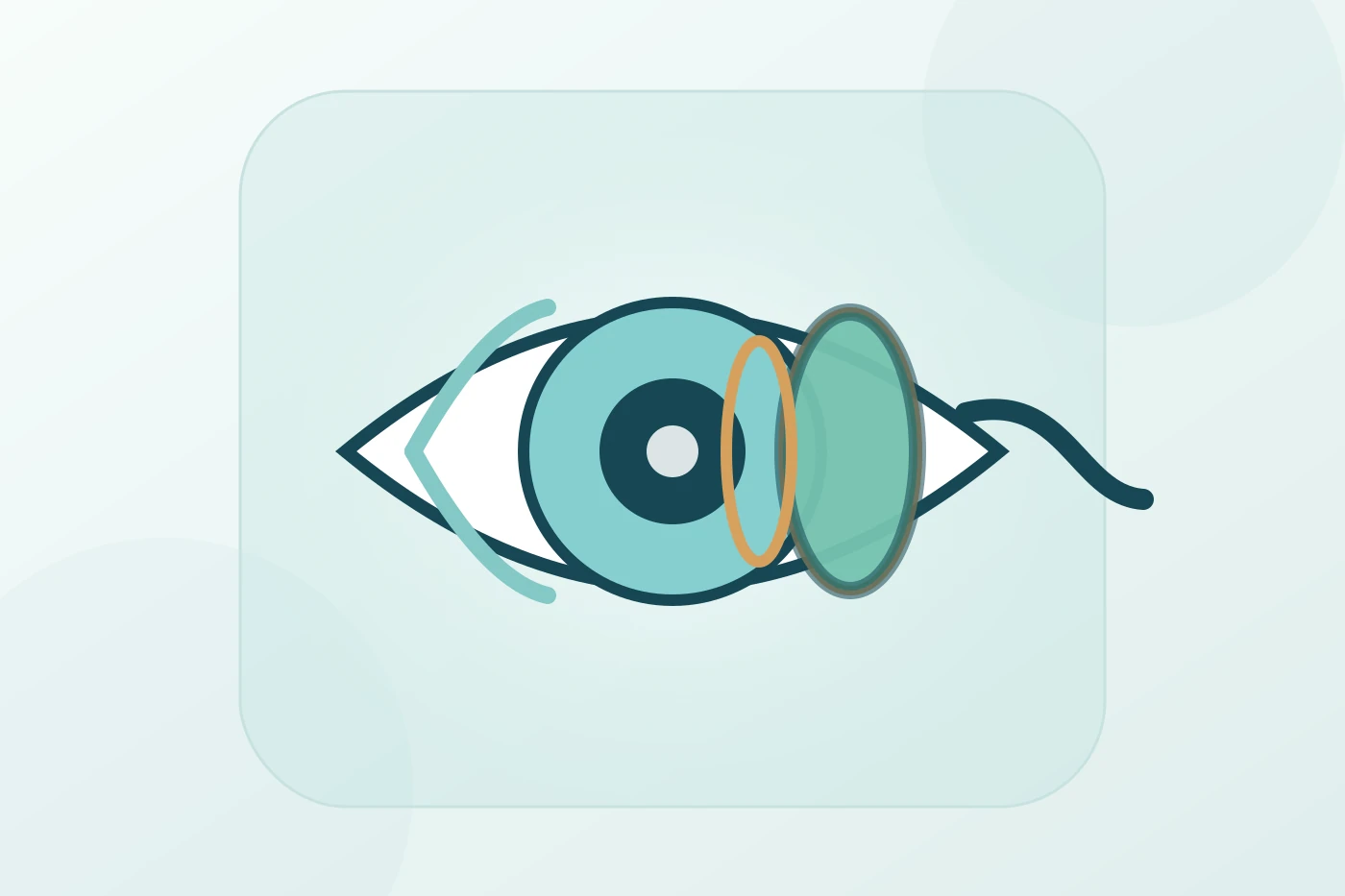Patient comparing ICL and LASIK with an ophthalmologist using eye models and diagnostic equipment to assess corneal health, prescription and treatment suitability.