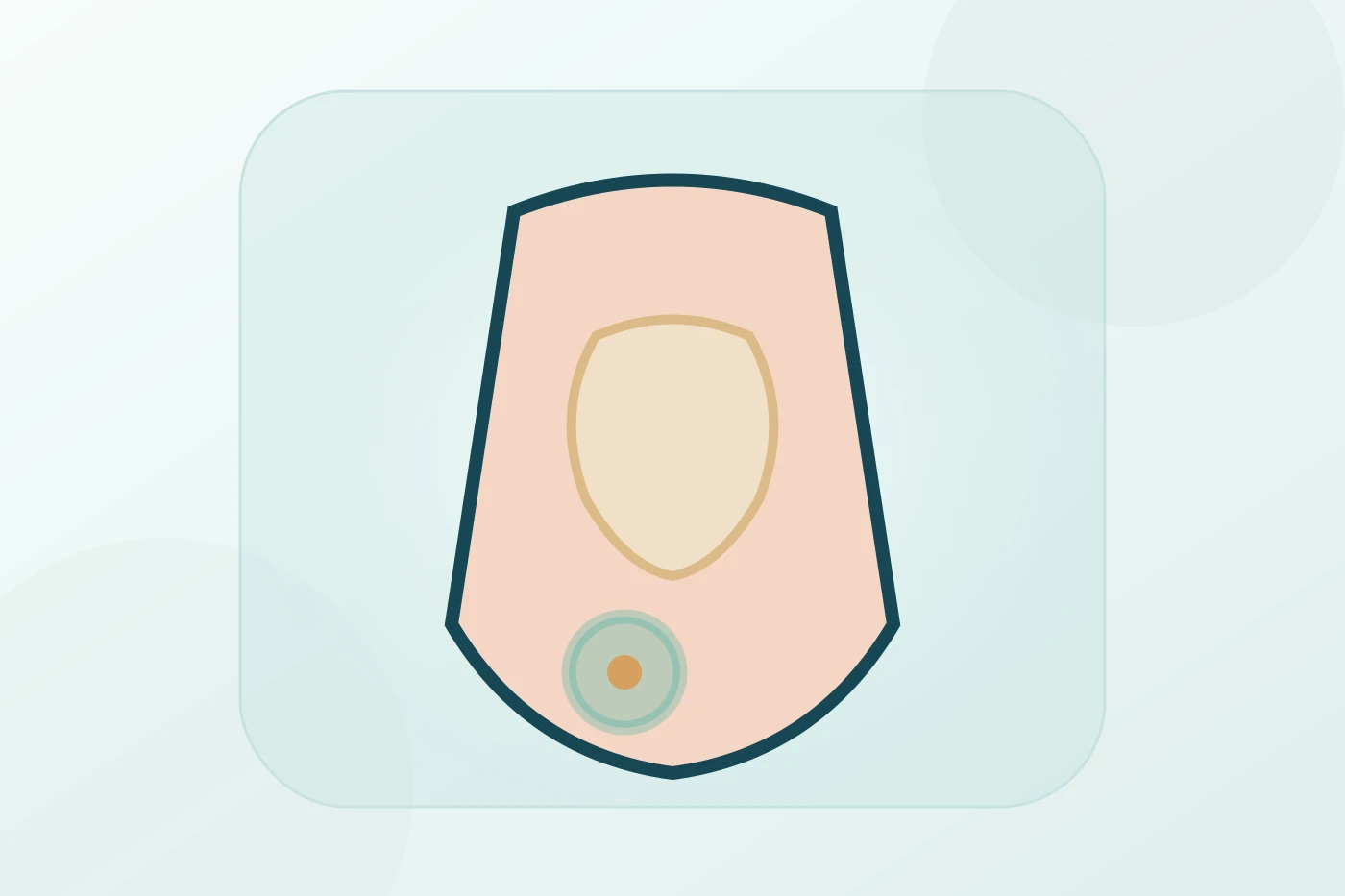 Inguinal Hernia Repair