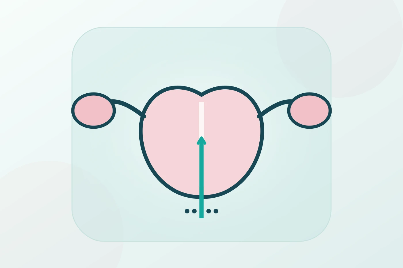 Intrauterine Insemination (IUI)