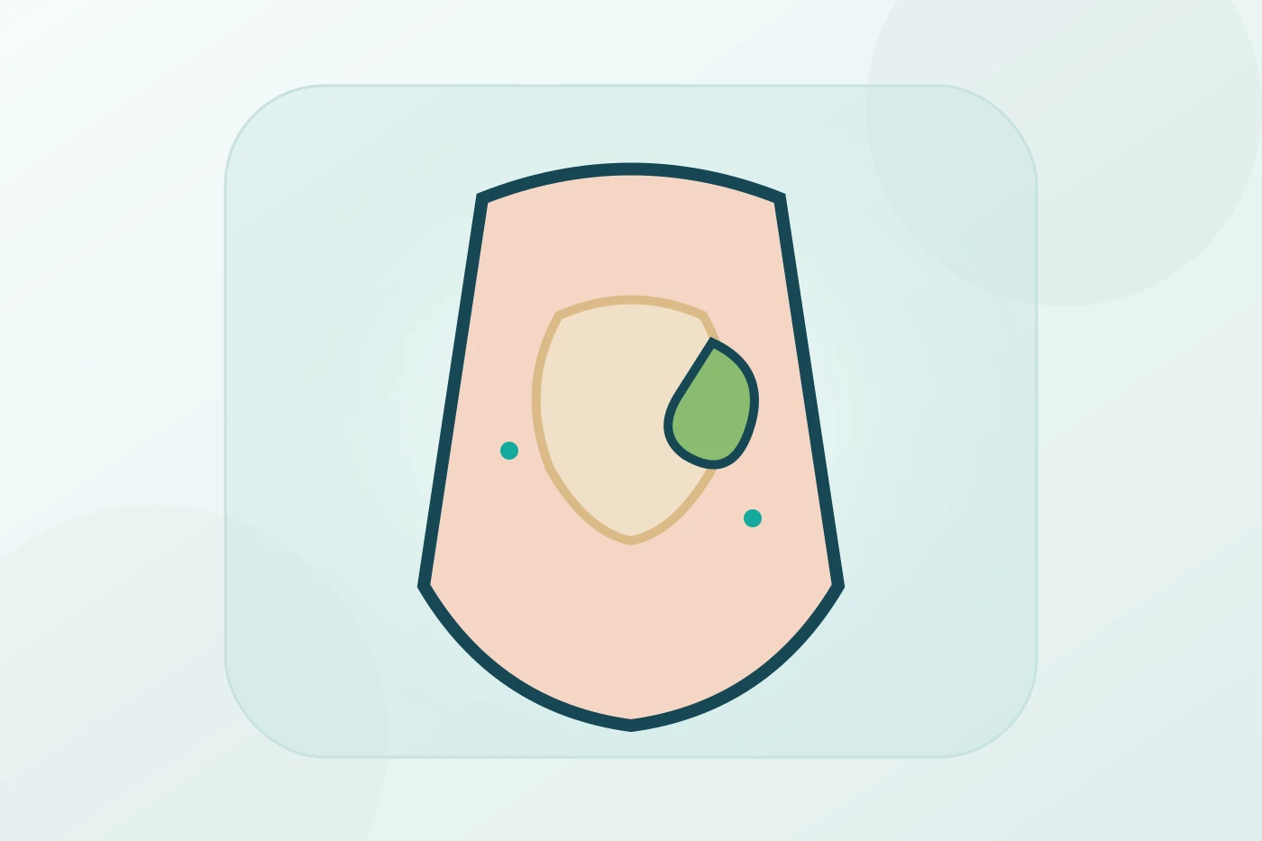 Laparoscopic Cholecystectomy