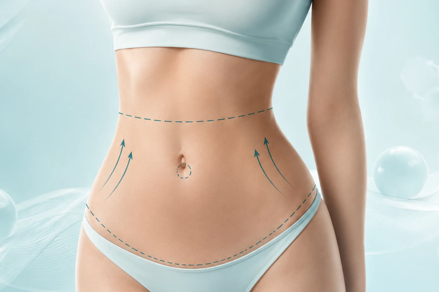 Liposuction