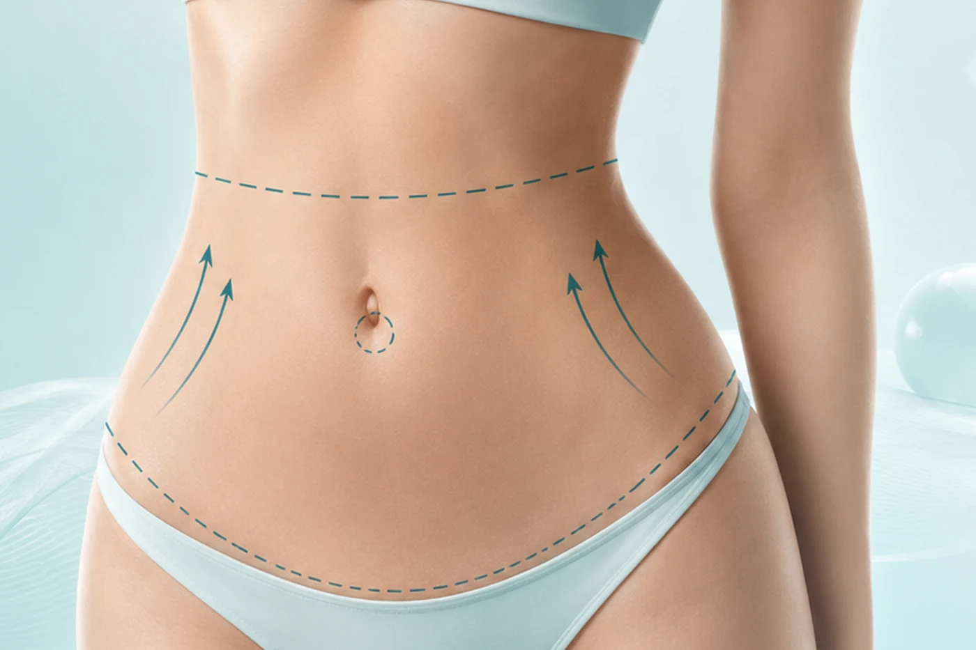 Tummy Tuck / Abdominoplasty treatment overview