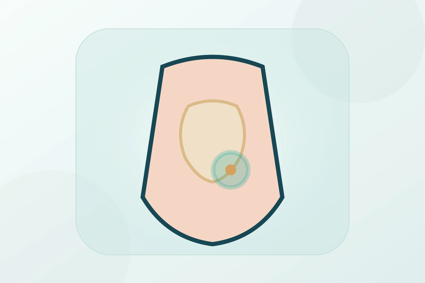Ventral / Incisional Hernia Repair