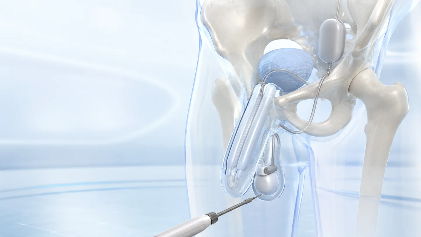 Penile Implant Surgery