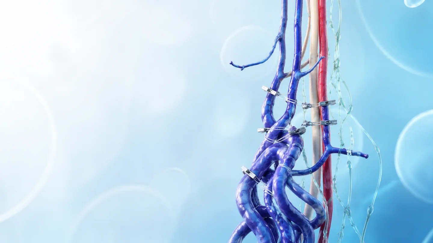 Varicocelectomy