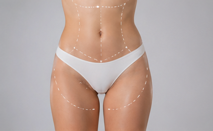 Comprehensive Lower Body Reshaping