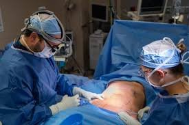 Comprehensive Abdominal Reshaping