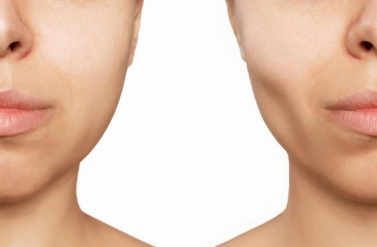 Minimally Invasive Technique