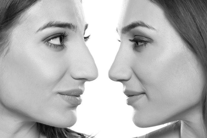 Minimally Invasive Techniques