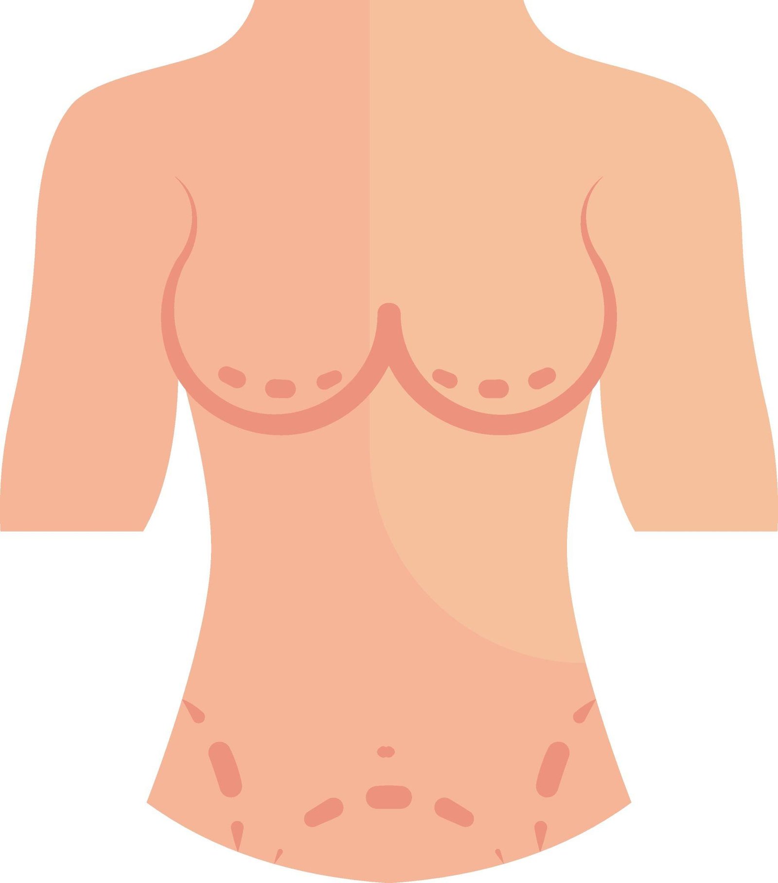 Customized Size Reduction