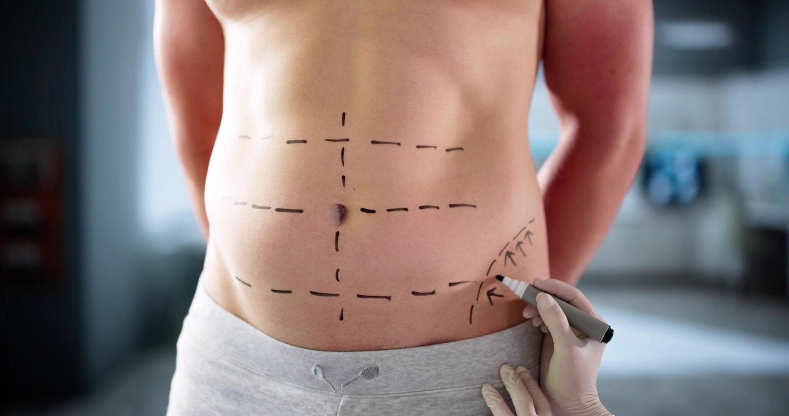 Advanced and Minimally Invasive Techniques